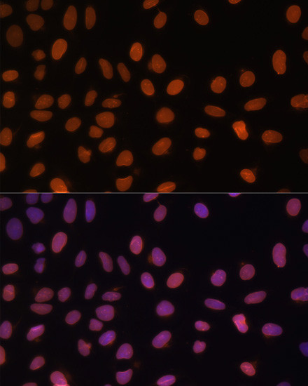 Lamin A/C Antibody in Immunocytochemistry (ICC/IF)