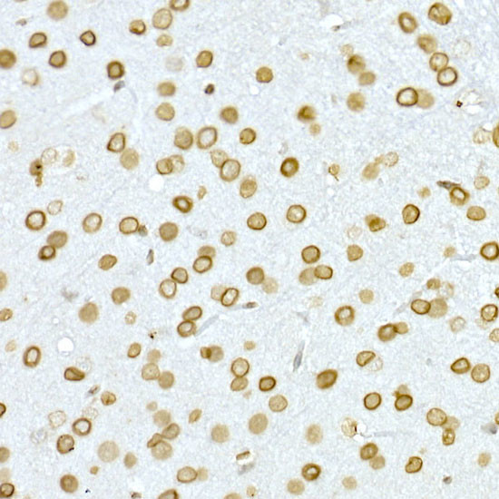 Lamin A/C Antibody in Immunohistochemistry (Paraffin) (IHC (P))