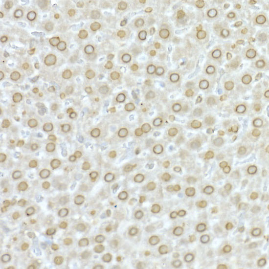 Lamin A/C Antibody in Immunohistochemistry (Paraffin) (IHC (P))