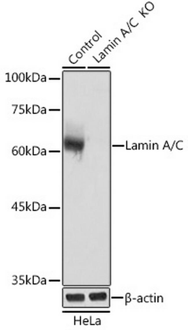 Lamin A/C Antibody