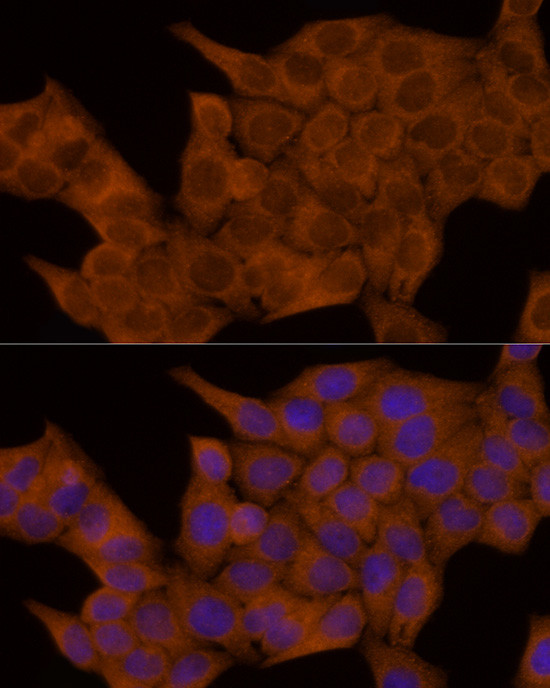 GSDMD Antibody in Immunocytochemistry (ICC/IF)