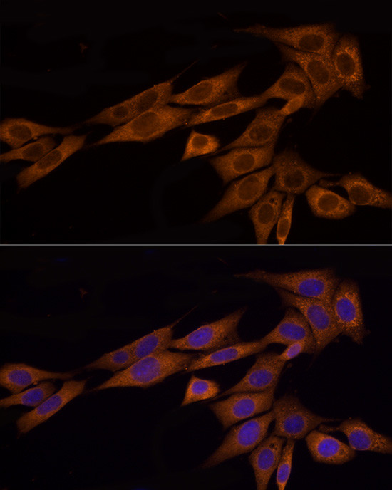 GSDMD Antibody in Immunocytochemistry (ICC/IF)