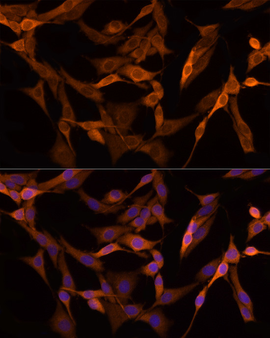 GSDMD Antibody in Immunocytochemistry (ICC/IF)