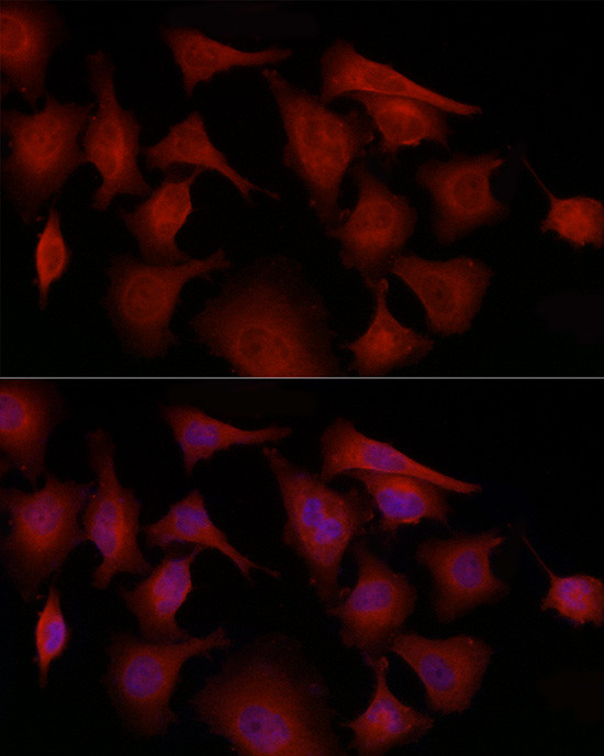 GSDMD Antibody in Immunocytochemistry (ICC/IF)