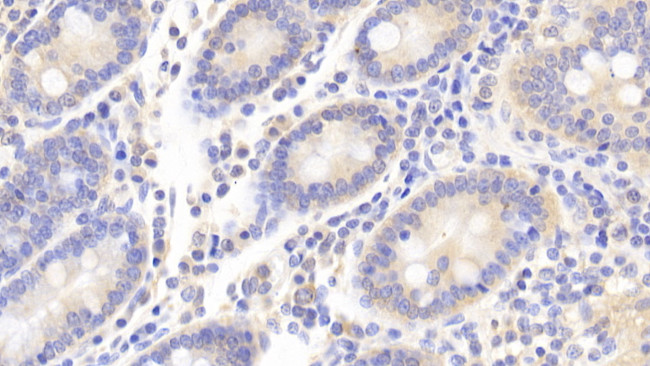 Caspase 1 Antibody in Immunohistochemistry (Paraffin) (IHC (P))