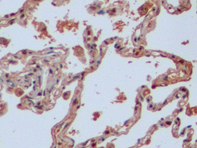 IDH1 Antibody in Immunohistochemistry (Paraffin) (IHC (P))