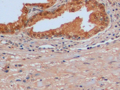 IDH1 Antibody in Immunohistochemistry (Paraffin) (IHC (P))