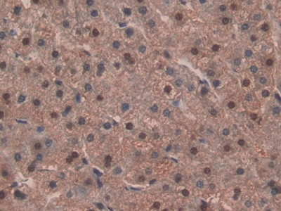 IDH1 Antibody in Immunohistochemistry (Paraffin) (IHC (P))