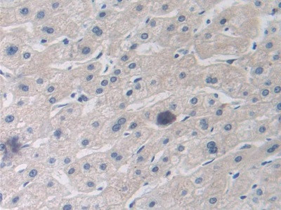 MX1 Antibody in Immunohistochemistry (Paraffin) (IHC (P))