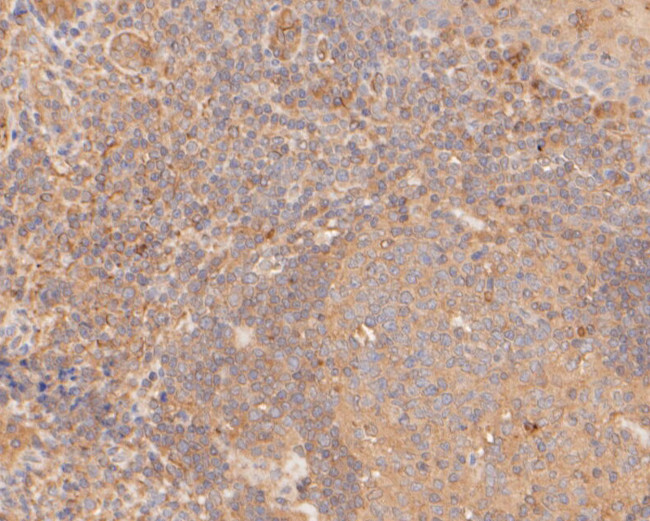 GSDMD Antibody in Immunohistochemistry (Paraffin) (IHC (P))