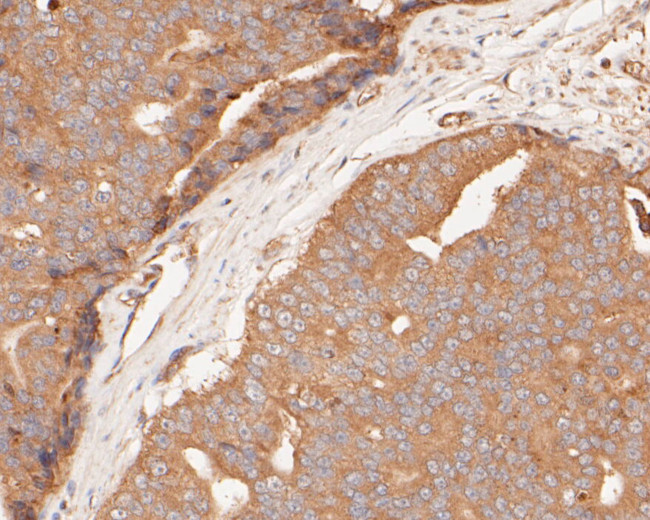 GSDMD Antibody in Immunohistochemistry (Paraffin) (IHC (P))