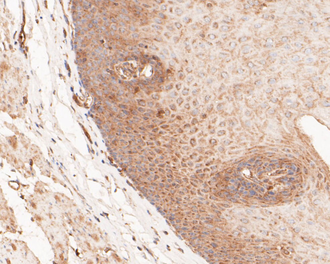 GSDMD Antibody in Immunohistochemistry (Paraffin) (IHC (P))