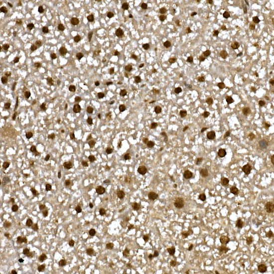 PPAR gamma Antibody in Immunohistochemistry (Paraffin) (IHC (P))