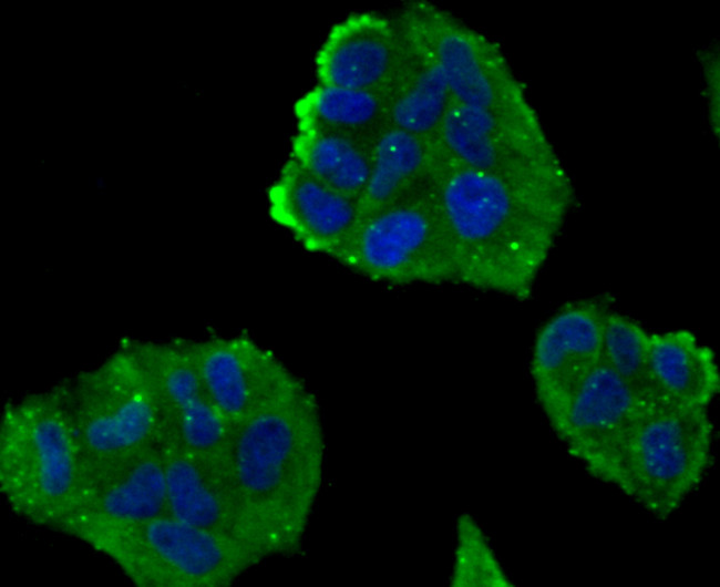 NOX2 Antibody in Immunocytochemistry (ICC/IF)