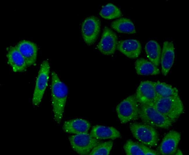 NOX2 Antibody in Immunocytochemistry (ICC/IF)