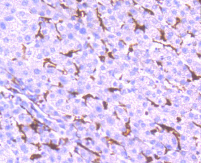 NOX2 Antibody in Immunohistochemistry (Paraffin) (IHC (P))