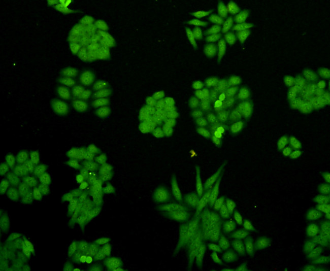 Cyclin D1 Antibody in Immunocytochemistry (ICC/IF)