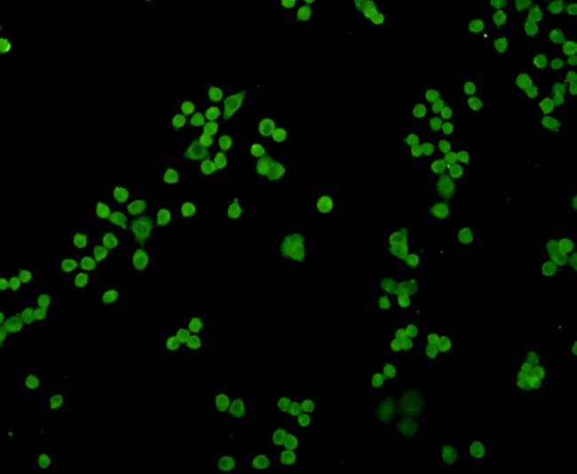 Cyclin D1 Antibody in Immunocytochemistry (ICC/IF)