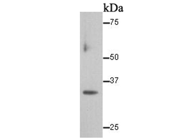 Cyclin D1 Antibody in Western Blot (WB)