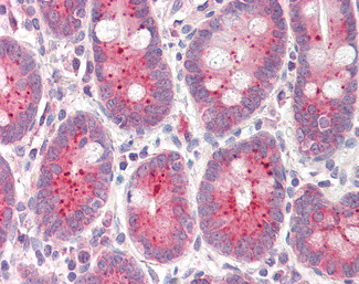 NQO1 Antibody in Immunohistochemistry (Paraffin) (IHC (P))