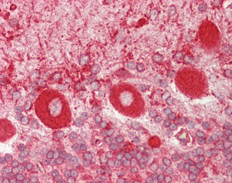 Calreticulin Antibody in Immunohistochemistry (Paraffin) (IHC (P))