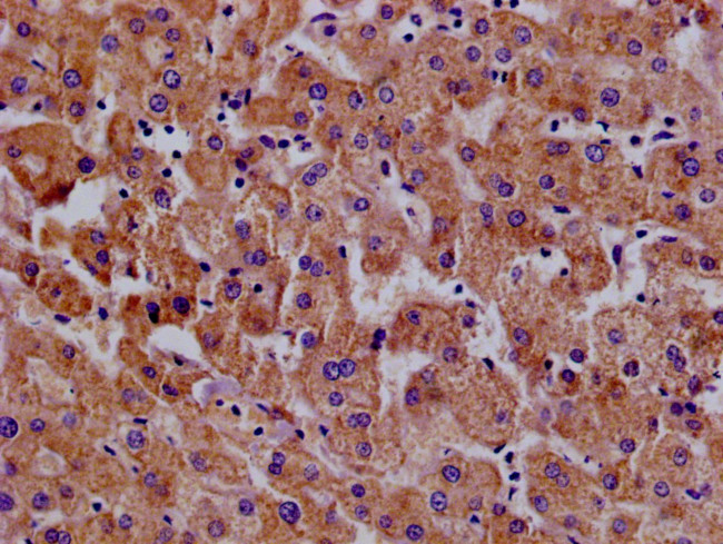 MX1 Antibody in Immunohistochemistry (Paraffin) (IHC (P))