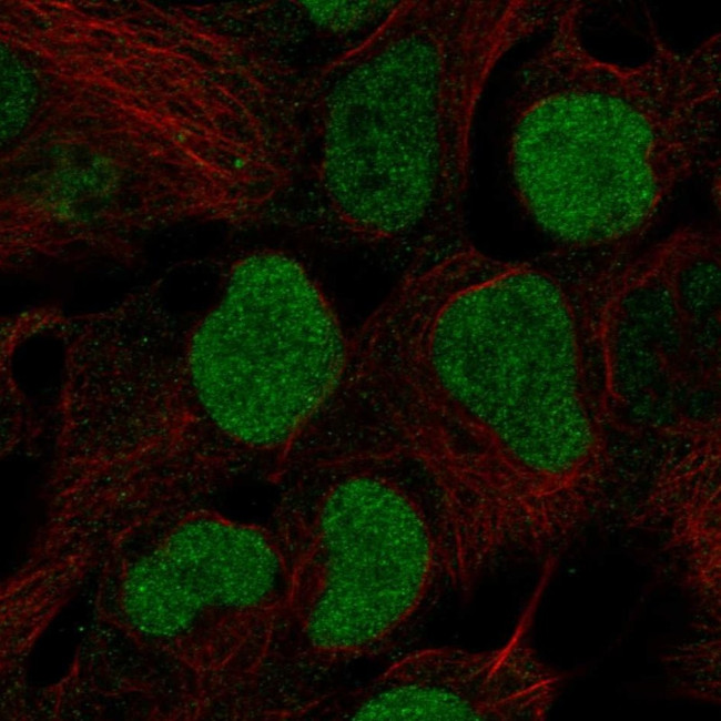 BRD2 Antibody in Immunocytochemistry (ICC/IF)