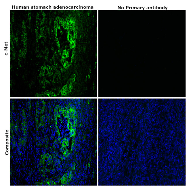 c-Met Antibody in Immunohistochemistry (Paraffin) (IHC (P))