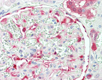 NQO1 Antibody in Immunohistochemistry (Paraffin) (IHC (P))