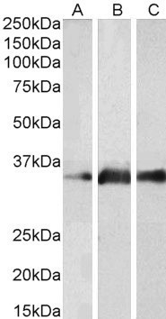 Kallikrein 5 Antibody in Western Blot (WB)