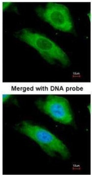 NQO1 Antibody in Immunocytochemistry (ICC/IF)