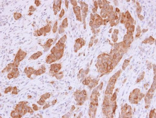 NQO1 Antibody in Immunohistochemistry (Paraffin) (IHC (P))