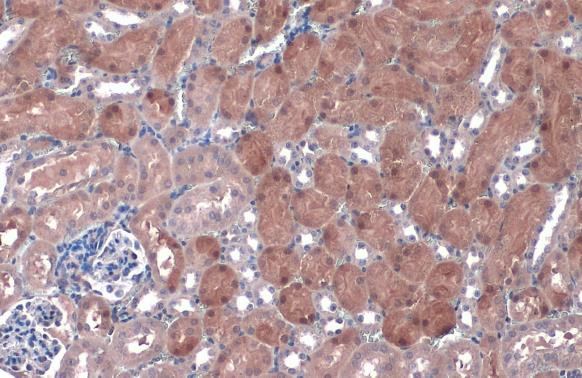 NQO1 Antibody in Immunohistochemistry (Paraffin) (IHC (P))