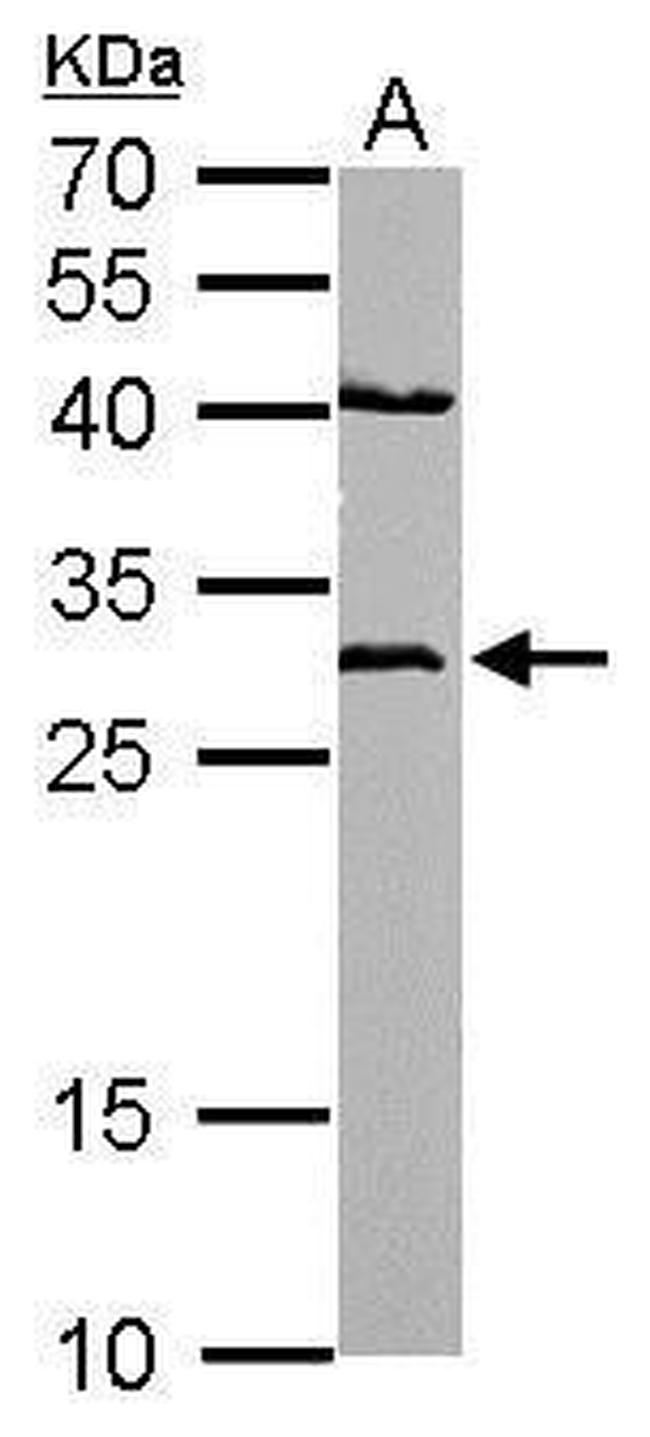 NQO1 Antibody in Western Blot (WB)