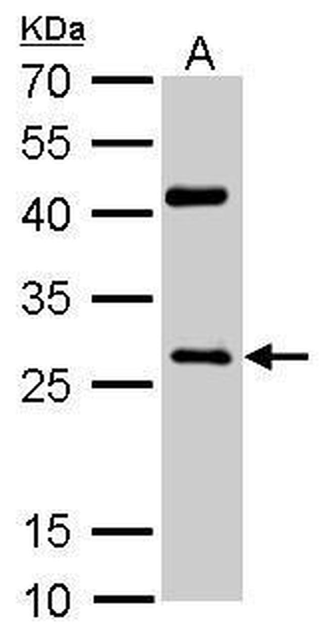 NQO1 Antibody in Western Blot (WB)