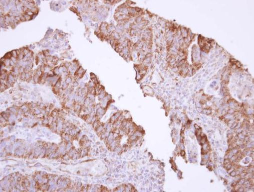 MX1 Antibody in Immunohistochemistry (Paraffin) (IHC (P))