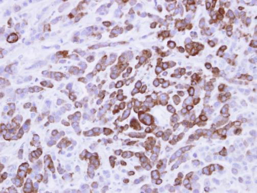 MX1 Antibody in Immunohistochemistry (Paraffin) (IHC (P))