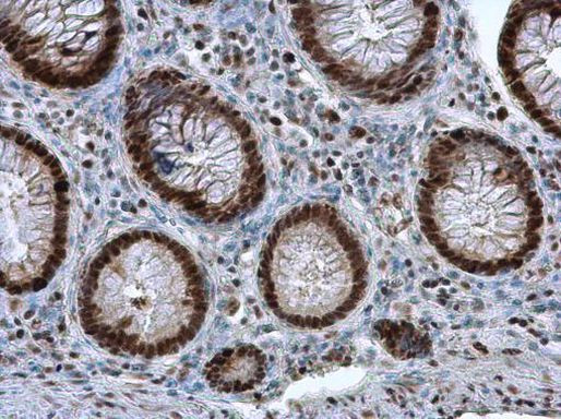 PCNA Antibody in Immunohistochemistry (Paraffin) (IHC (P))