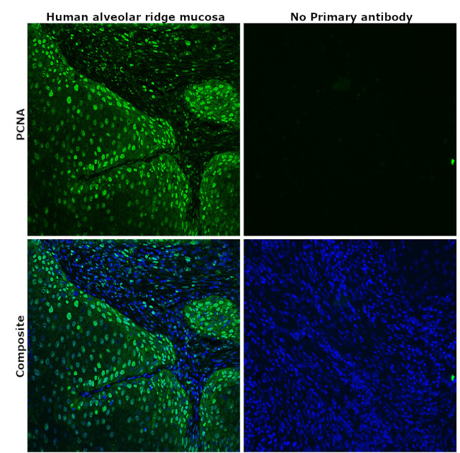 PCNA Antibody in Immunohistochemistry (Paraffin) (IHC (P))