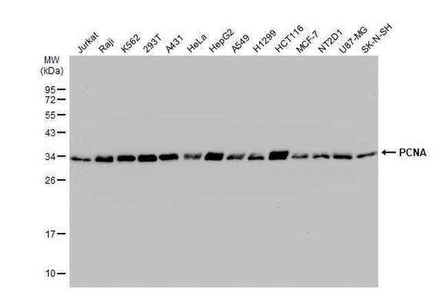 PCNA Antibody in Western Blot (WB)