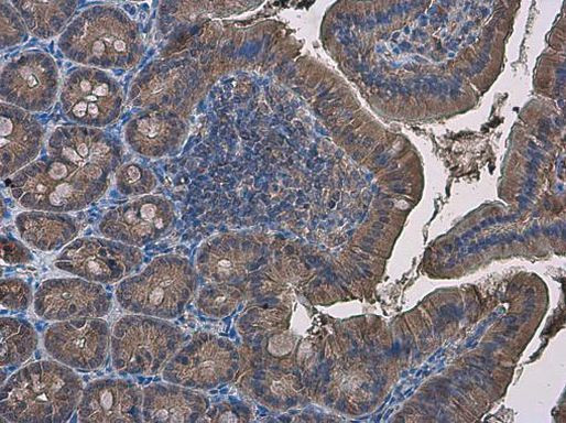 IDH1 Antibody in Immunohistochemistry (Paraffin) (IHC (P))