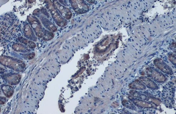 IDH1 Antibody in Immunohistochemistry (Paraffin) (IHC (P))