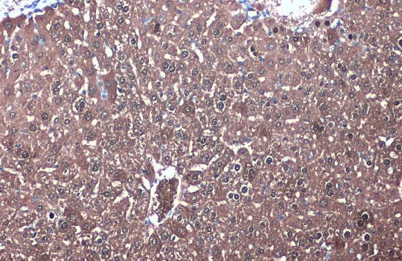 IDH1 Antibody in Immunohistochemistry (Paraffin) (IHC (P))