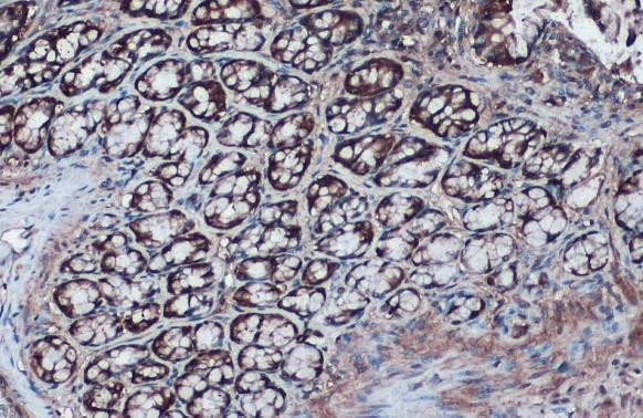 IDH1 Antibody in Immunohistochemistry (Paraffin) (IHC (P))