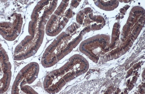 IDH1 Antibody in Immunohistochemistry (Paraffin) (IHC (P))