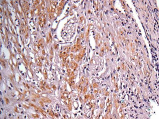 IDH1 Antibody in Immunohistochemistry (Paraffin) (IHC (P))