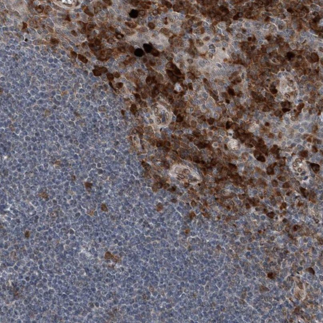 ICB-1 Antibody in Immunohistochemistry (IHC)