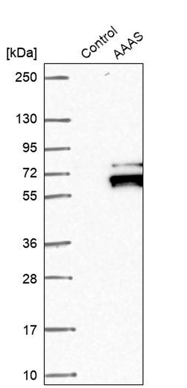 Aladin Polyclonal Antibody (PA5-59060)