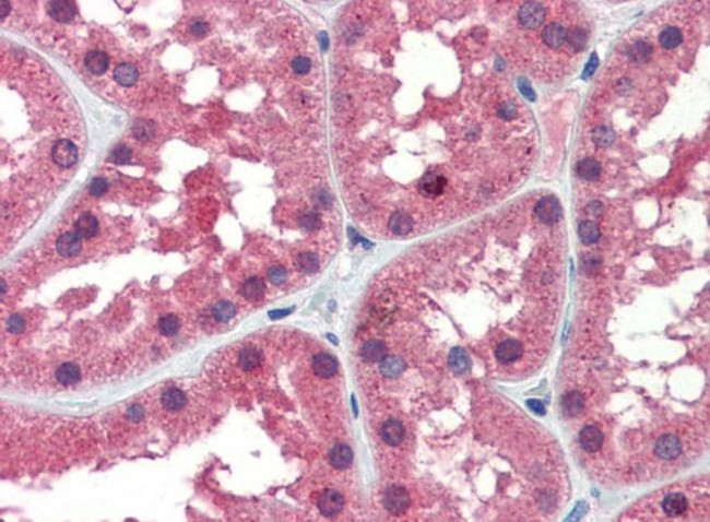 IDH1 Antibody in Immunohistochemistry (IHC)