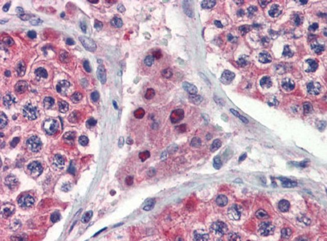 IDH1 Antibody in Immunohistochemistry (IHC)